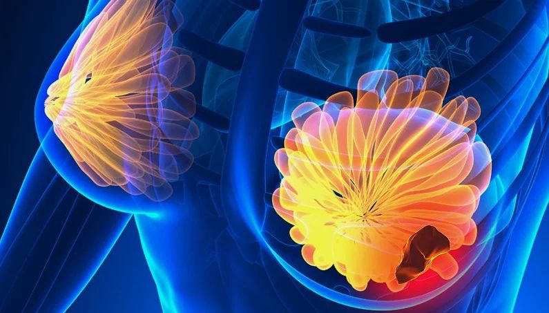 Interviu – Adina Cîrjan despre cartea „Totul despre sâni” vol. I de Gabi Bădăluță